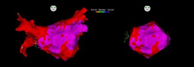 Unraveling the interplay: early-stage atrial functional mitral regurgitation and left atrial electrical substrate in atrial fibrillation patients